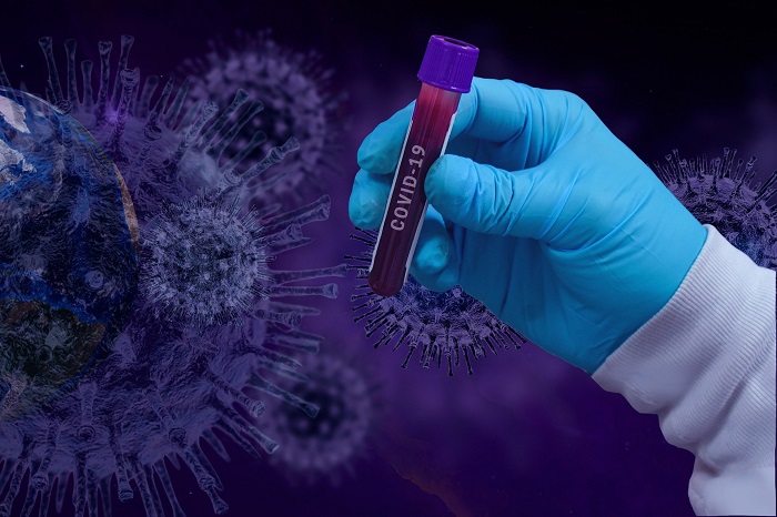 미국 국가정보국은 코로나19 유발 바이러스에 대해 사람이 만들거나 변형된 것이 아니라는 과학적 합의에 동의한다는 입장을 밝혔다. / 픽사베이