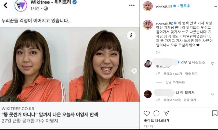 똥색 안색 논란 기사에 정공법을 보여준 이영지 / 이영지 인스타그램
