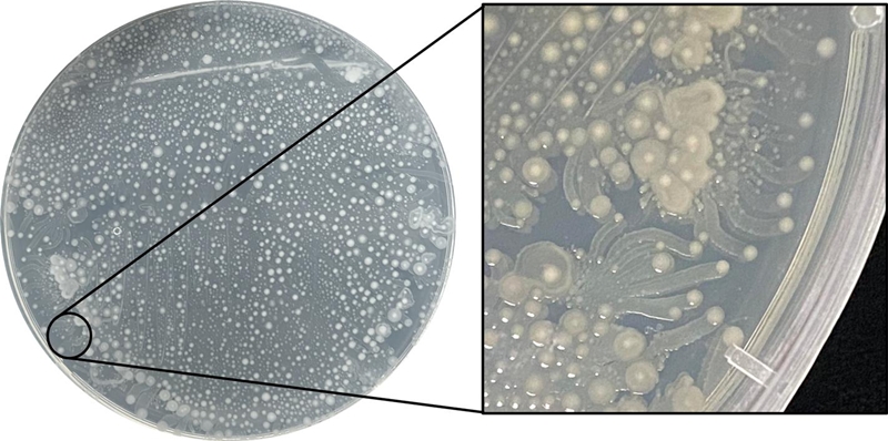 극지연구소 김옥선 박사 연구팀이 틱스 빙하에서 채취한 빙하코어를 분석해 확보한 빙하 미생물의 모습./ 극지연구소