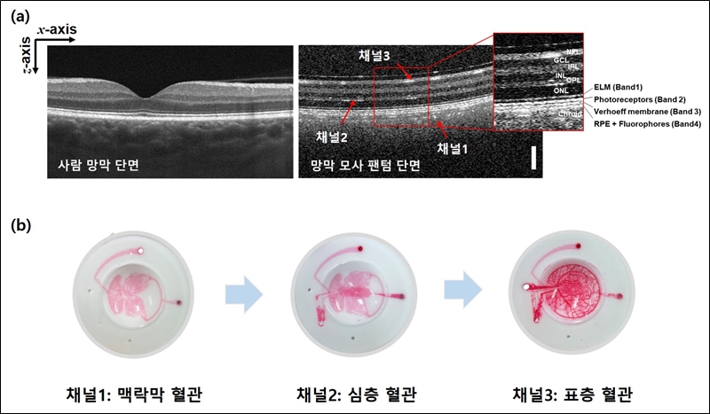 사진은 연구팀이 개발한 망막 모사 안구 팬텀의 구조./ 한국표준과학연구원