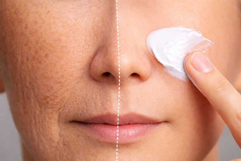 달리기는 노화를 촉진하는 것이 아닌, 노화를 방지하는 좋은 수단이다. 하지만 야외 달리기 시 햇빛에 노출되면 광노화가 발생한다. 따라서 이를 막기 위해선 선크림과 같은 자외선 차단제를 바르고 수분섭취를 해야한다. 또한 지나친 운동은 반응성 산소종 등을 유발해 노화가 발생할 수 있어 주의가 필요하다./ 생성형 AI로 제작한 이미지