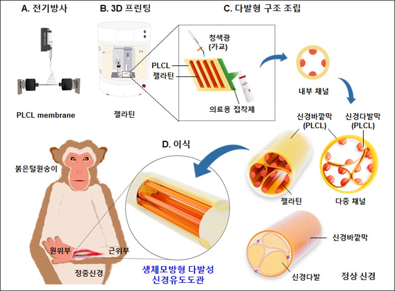 ‘한국과학기술연구원(KIST)’ 연구진은 16일 ‘다발형 인공 신경도관(MFNGC)’을 새롭게 개발했다. 사진은 KIST 연구진이 고안한 생체모방향 다발성 신경유도도관 기술 모식도. / KIST